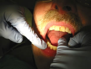 Dental checkup in progress